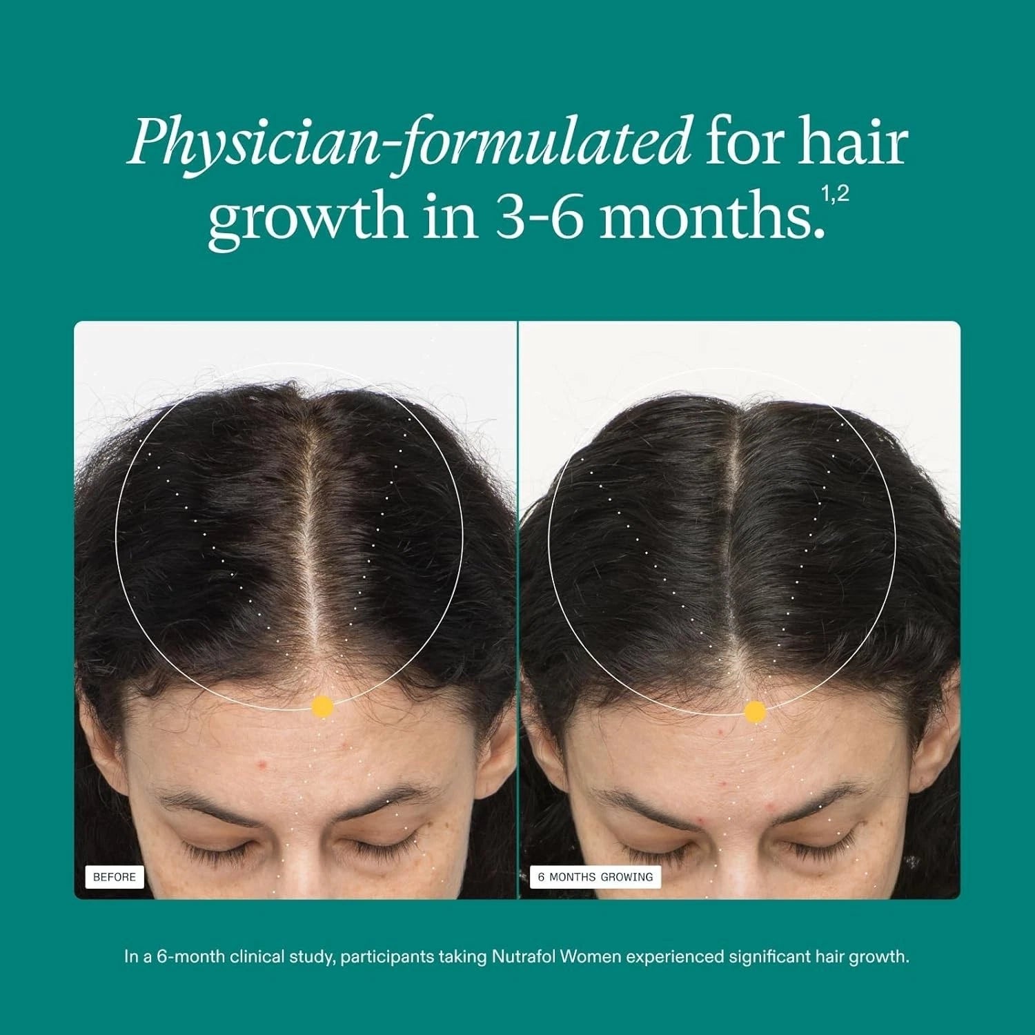 Nutrafol Women's Hair Growth Supplements,