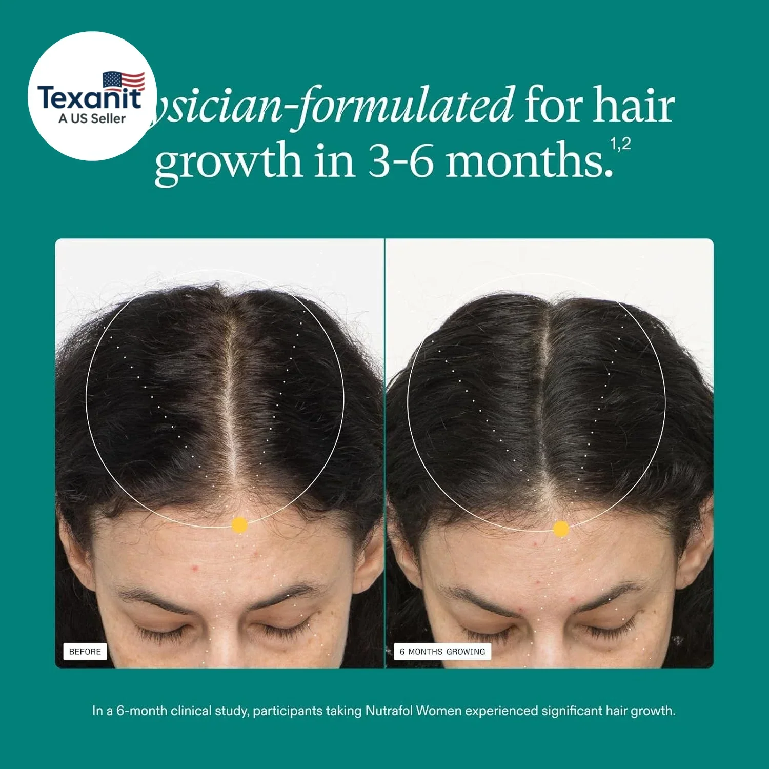 Pack of 3 Women’s Hair Growth Supplement 360 Caps – Fast Shipping Ages 18 - 44